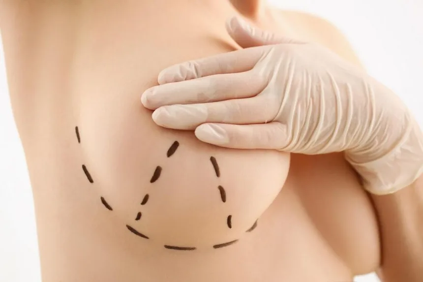 Okres rekonwalescencji po zabiegu powiększenia piersi